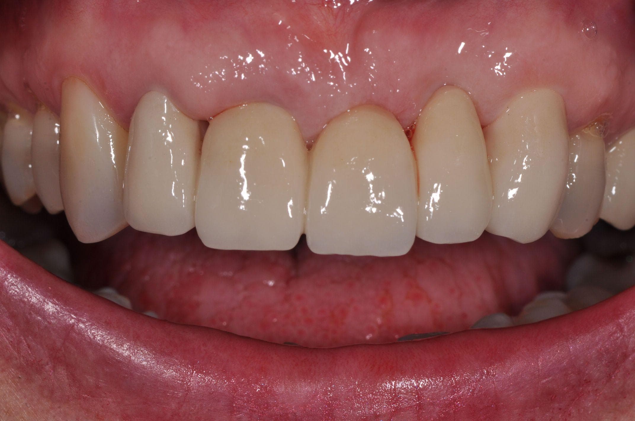 Rehabilitación Oral