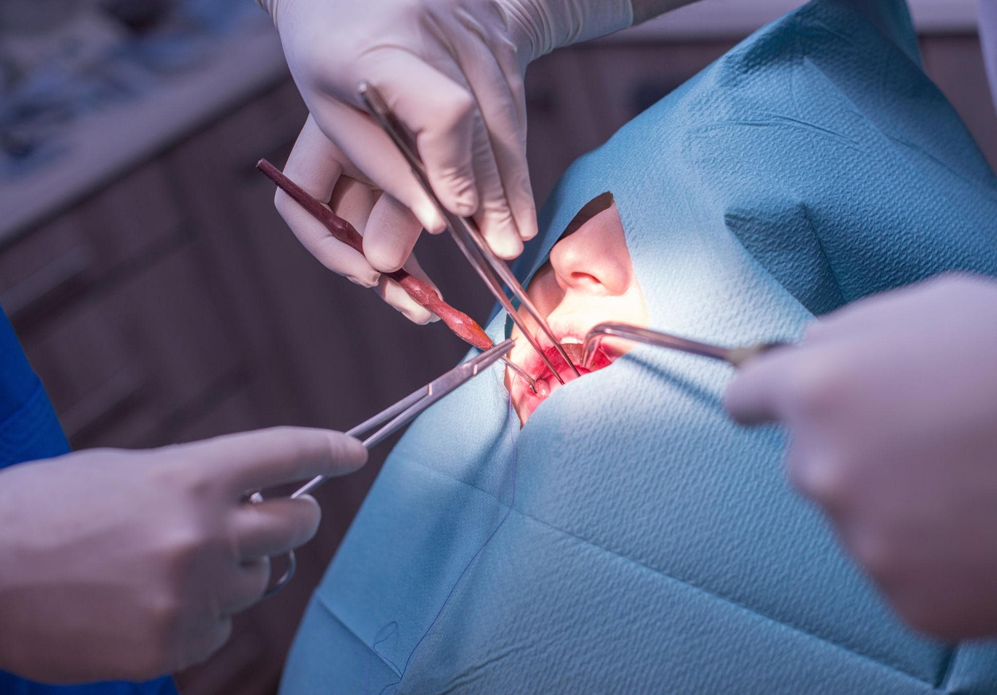 Cirugía Dental